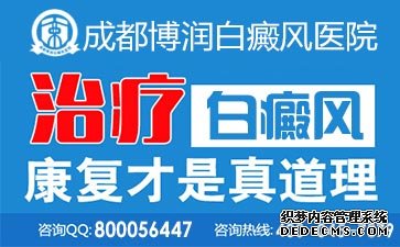 手白癜风的原因主要是什么?