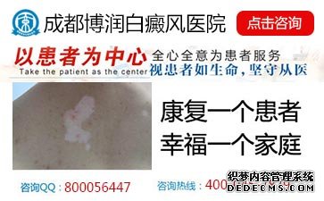 白癜风患者能染发吗