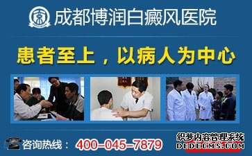 白癜风开始时什么症状