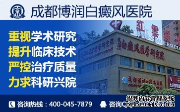 白癜风风早期症状