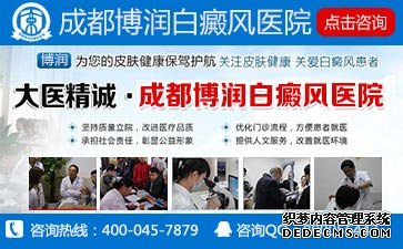 白癜风患者饮食一个注意什么