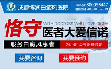 节段型白癜风症状