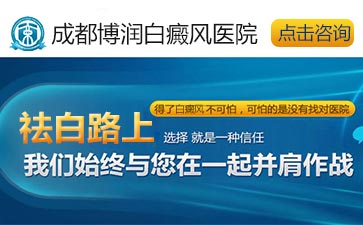 儿童白癜风发病症状