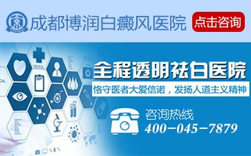 儿童白癜风症状
