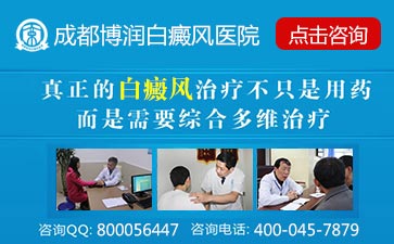 颈部白癜风症状