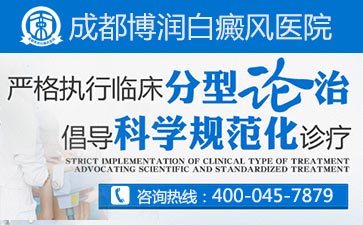 治疗白癜风的最好方法