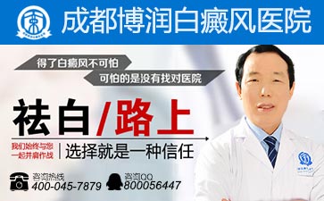 激光治疗白癜风多少钱
