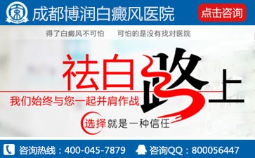 怎样治疗白癜风