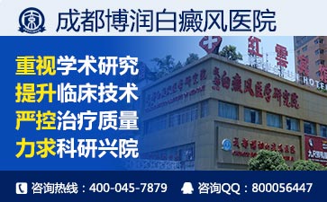 儿童白癜风病因