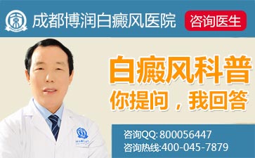有关白癜风的治疗方法