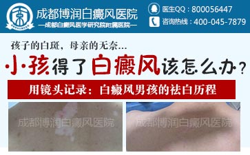 小腿由于外伤引起的白癜风怎么治疗